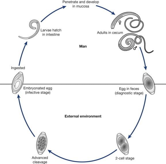 whipworm larvae