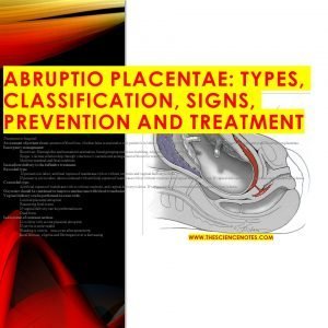 Abruptio placentae