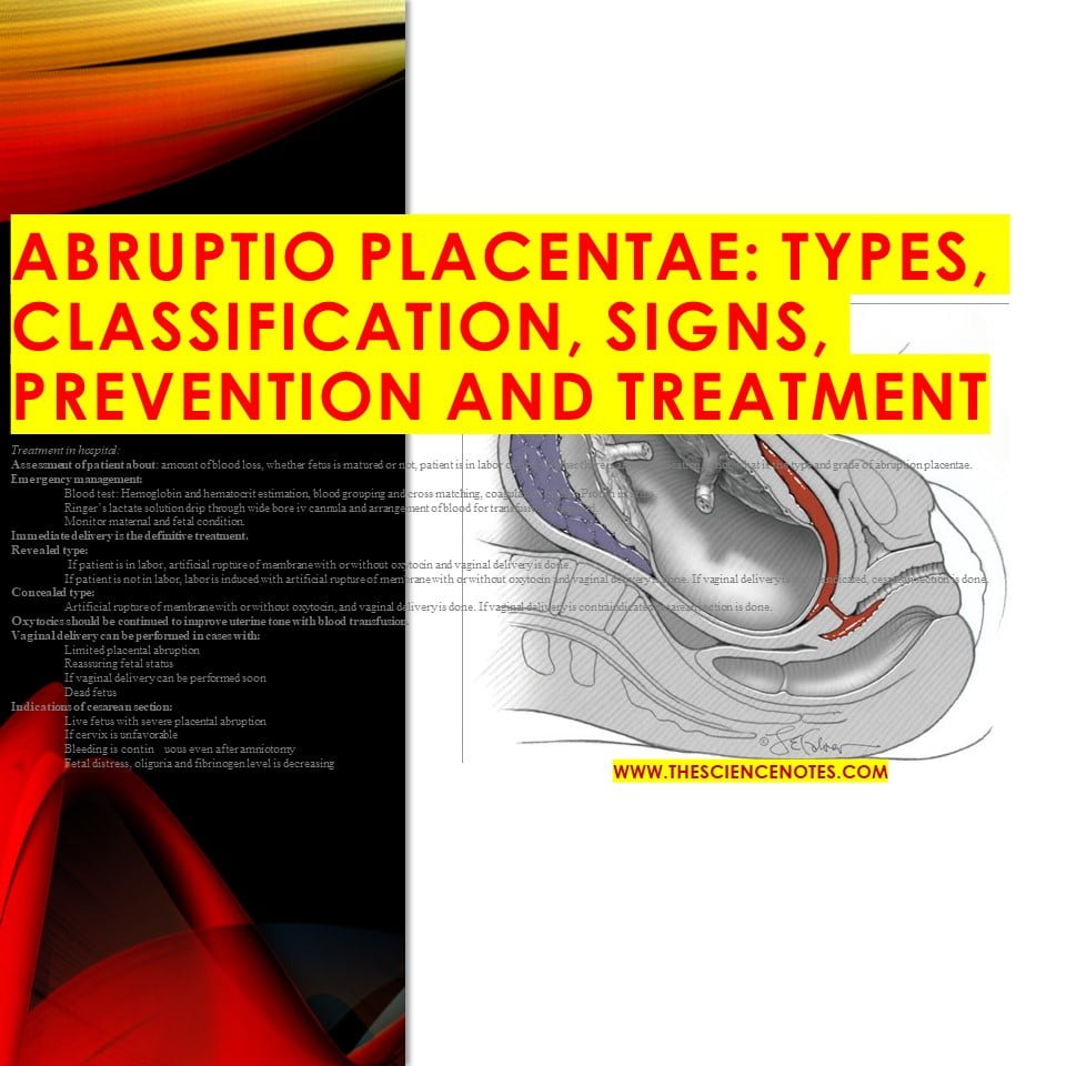 ABRUPTIO PLACENTAE TYPES CLASSIFICATION SIGNS PREVENTION AND TREATMENT The Science Notes