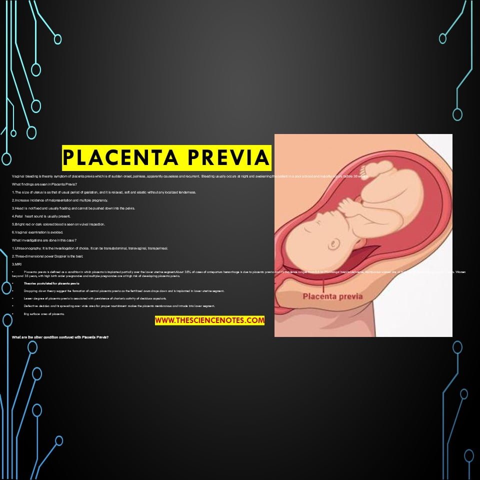 Classification Of Placenta Previa Rcog