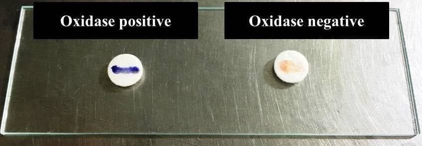oxidase test