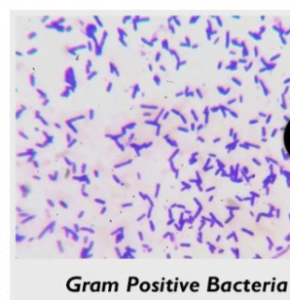 Differences between Gram-positive bacteria and Gram-negative bacteria