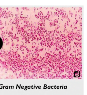 Differences Between Gram-Positive and Gram-Negative Bacteria ...