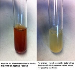 Biochemical Tests for Bacteria Identification: Types, Principle ...