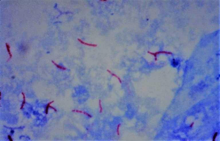 mycobacterium smegmatis gram stain