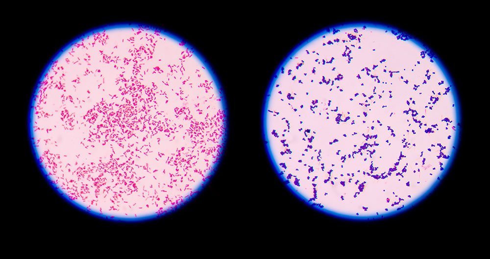 staphylococcus aureus acid fast stain