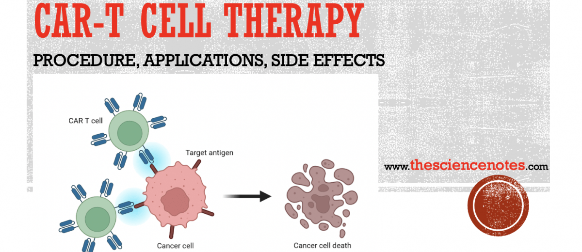 CAR T-cell therapy