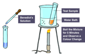 Benedict's test