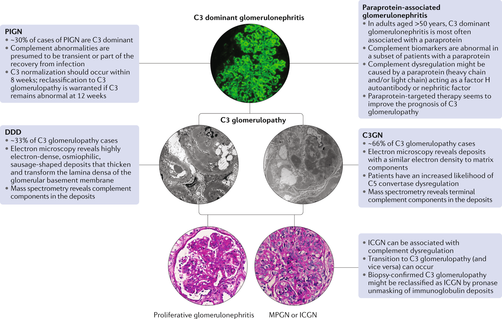 C3 dominant glomerulonephritis