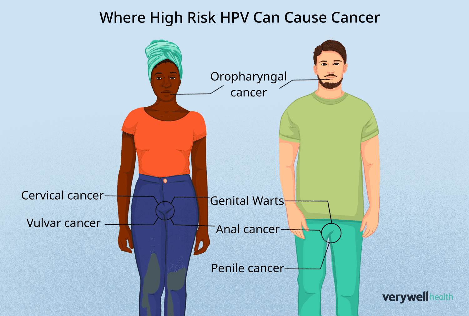 High-risk HPV