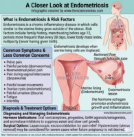 A medical infographic by thesciencenotes.com showing a cross-section of the uterus and the process of retrograde menstruation. It lists symptoms like pelvic pain and infertility, and treatment options including hormone therapy and surgery.